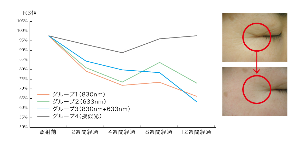 赤外線フェイスマスク、ハイアードーズ